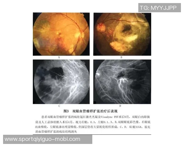 圣保罗俱乐部宣布奥斯卡因血管迷走神经性晕厥在家休养中 圣保罗俱乐部宣布奥斯卡因血管迷走神经性晕厥在家休养中